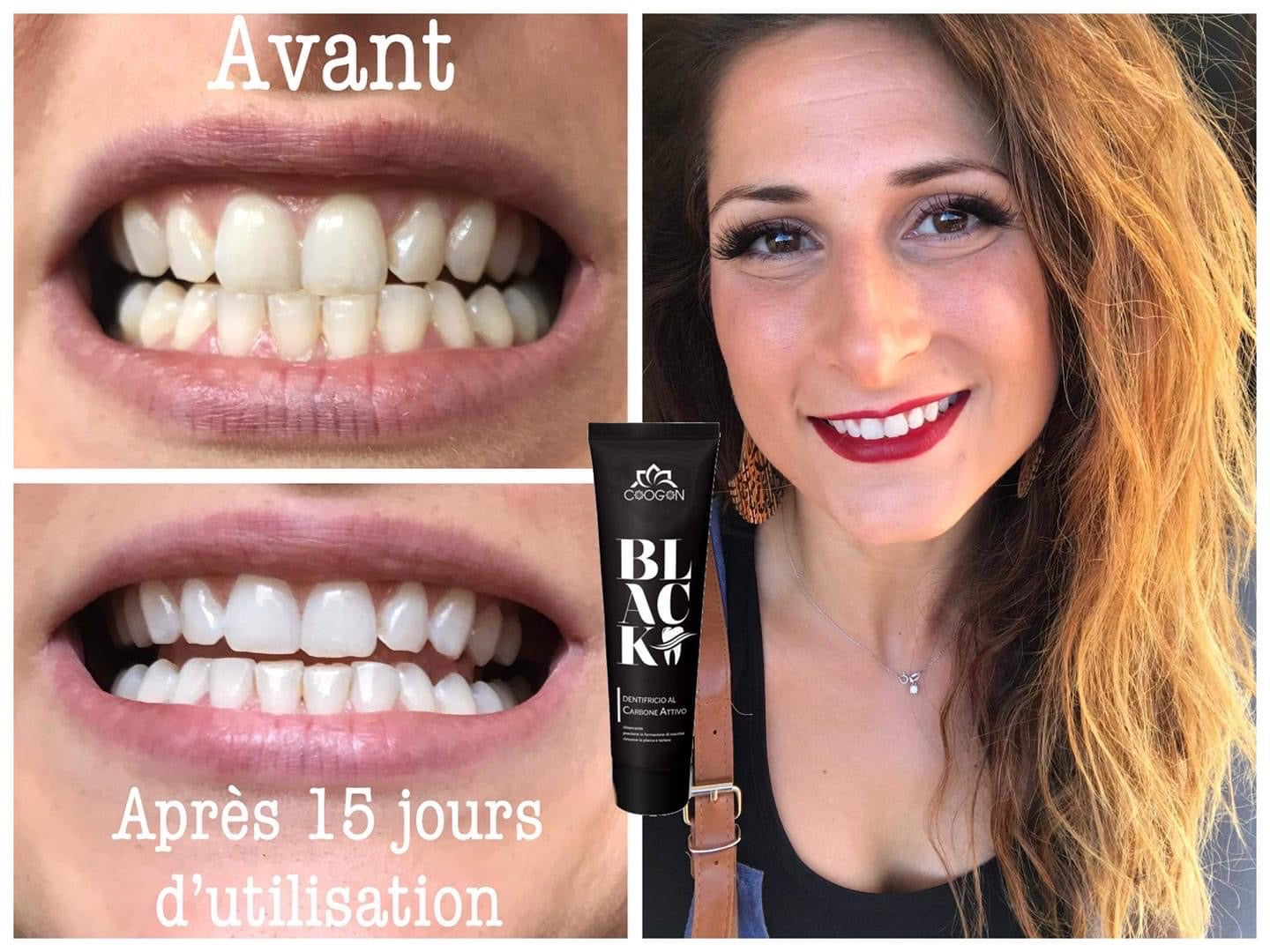 BLK01B : DENTIFRICE BLANCHISSANT AU CHARBON